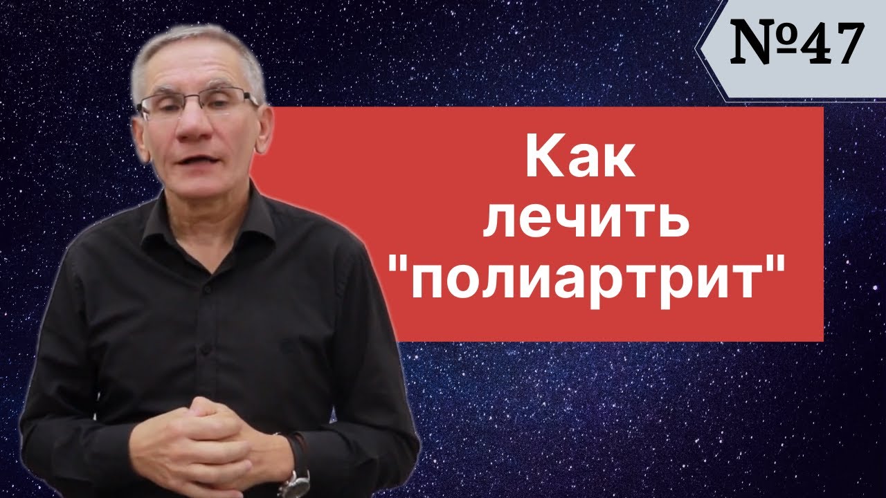Как лечить полиартрит? Выпуск №47 - YouTube