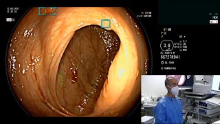 CAD EYE Fuji AI System for detection and characterization of colonic polyps - live demonstration screenshot 4