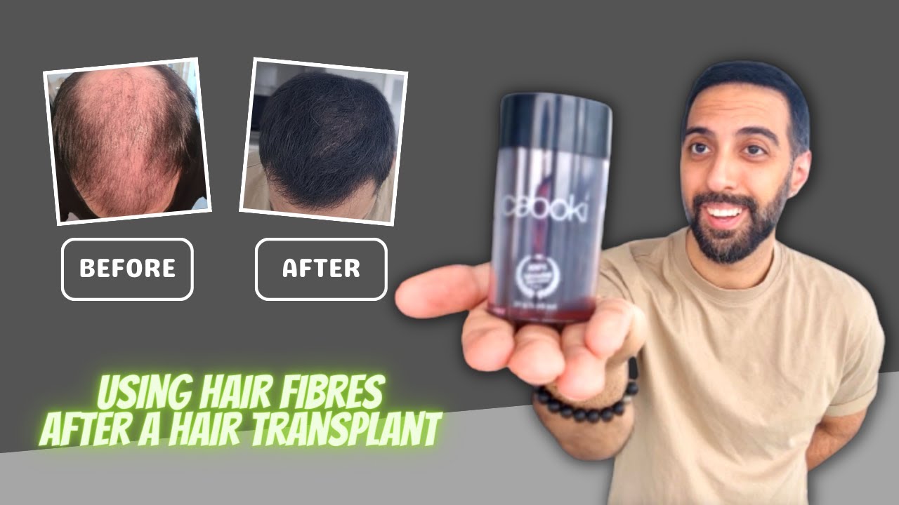 Using Hair Fibres After a Hair Transplant For the First Time - YouTube