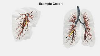 Resolution-Optimal Motion Planning for Steerable Needles