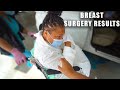 REVEALING MY *BREAST SURGERY RESULTS* (EMOTIONAL)