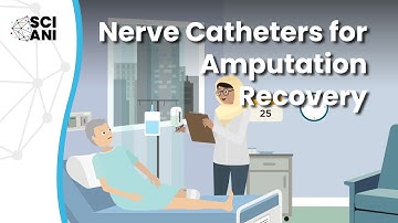 Do nerve catheters affect pain & recovery after amputation?