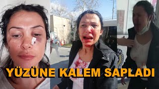 ÖĞRETMEN KALEMLE DEHŞET SAÇTI KAHRAMANMARAŞ’TA BİR ÖĞRETMEN, KOMŞUSUNA KALEMLE SALDIRDI