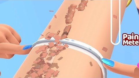 ‎Acne Runner - All Levels Gameplay Android, iOS