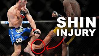Don't Be The Guy Who Shatters His Leg.. Condition Them!