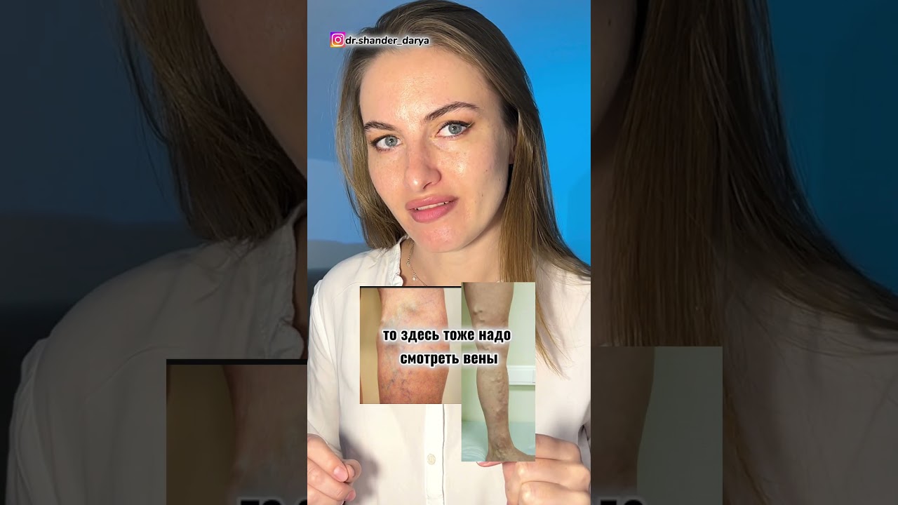 Показания для УЗИ сосудов ног #узисосудов #узи #калининград #тромбы #атеросклероз #бляшки #сосуды