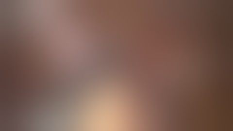 Laparoscopic appendectomy - symphysiolysis Part 2