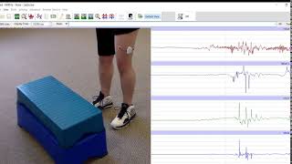ROAM Wireless EMG
