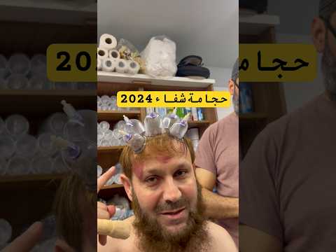 تبارك الله قال ﷺ خير ما تداويتم به الحجامة معجزة 