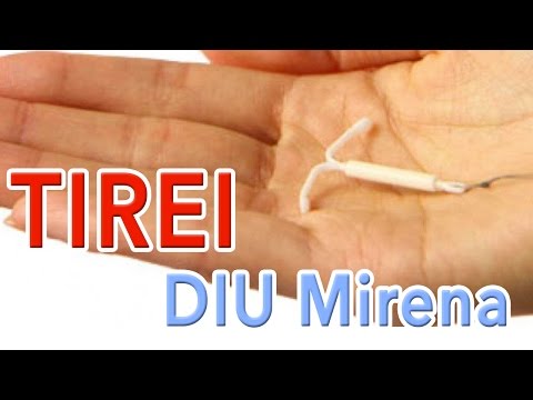 retirada diu mirena efeitos colaterais
