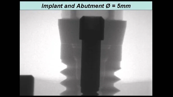 Zipprich   Micro Movements on Implant Abutment Int...
