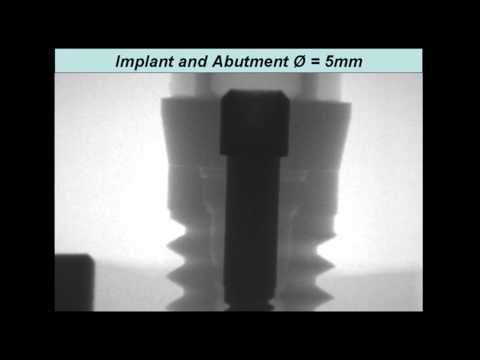 Zipprich   Micro Movements on Implant Abutment Interfaces part 1