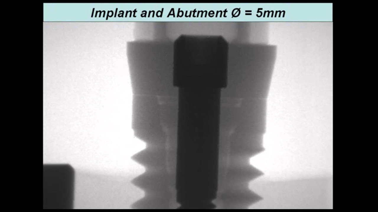 implants abutment