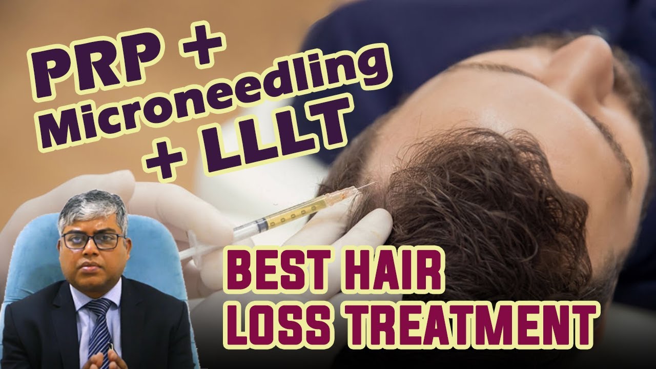 PRP Hair Loss Treatment in Hindi Does PRP Therapy Works? Best PRP