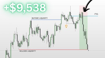 The Midas Model A+ Setup - GOLD Trade Breakdown