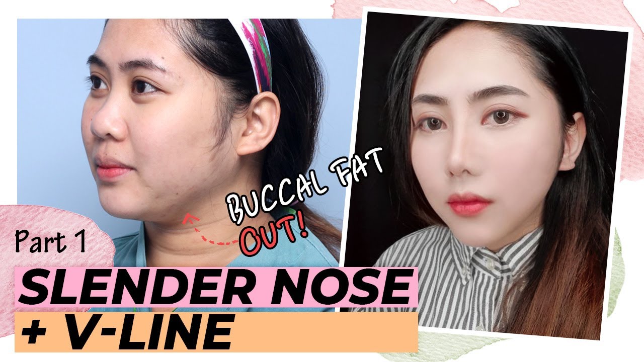 How Much Does It Cost To Get A Nose Job In South Korea?