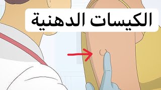 أسباب ظهور أكياس دهنية تحت الجلد | اعراض وعلاج الكيس الدهني تحت الجلد | Lipoma | الورم الشحمي |