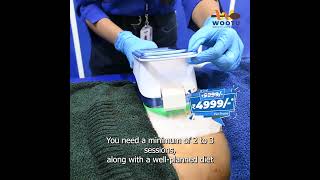 Say goodbye to stubborn fat with Cryolipolysis!