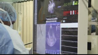 Jacksonville obtains AI technology that can treat atrial fibrillation