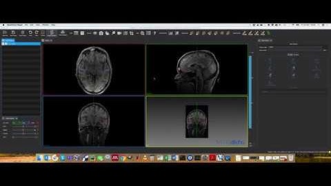 MPHY0026: Surface Rendering Example