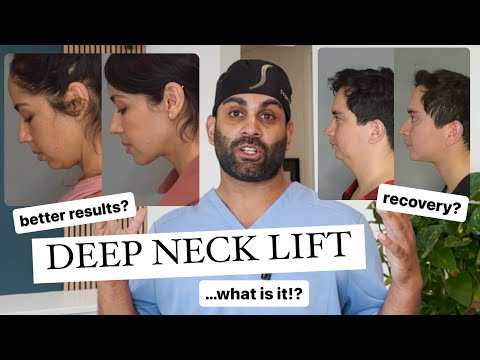 Deep Neck Lift