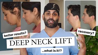 Deep Neck Lift *everything you need to know*