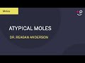 Atypical Moles: What Are They? [Dermatology] (2019)