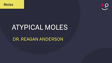 Should I be worried about an atypical mole?