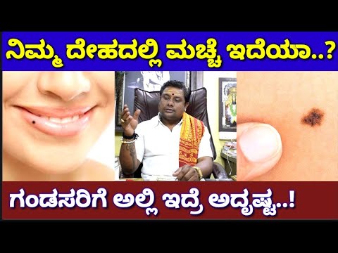 ಆ ಜಾಗದಲ್ಲಿ ಮಚ್ಚೆ ಇದ್ದರೆ ತುಂಬಾ ಅದೃಷ್ಟ | Black Moles On Body | Vasudevan | Newz Alert | Macche Kannada