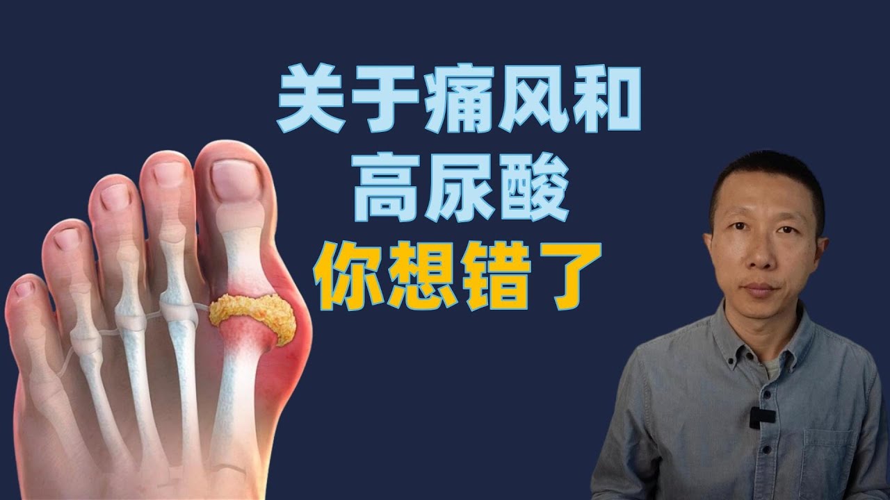 对痛风和高尿酸血症的认识误区（7个）