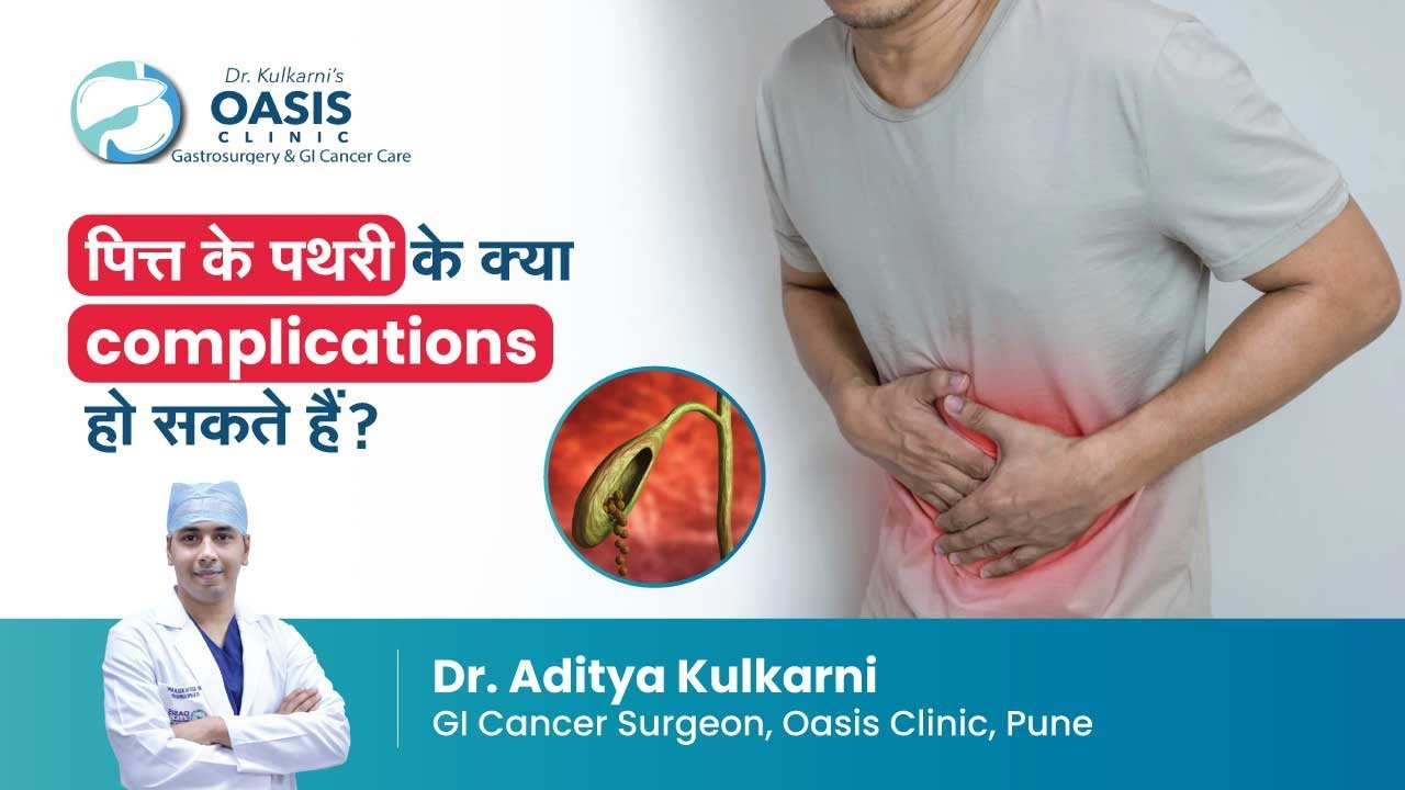 पित्त के पथरी के क्या complications हो सकते हैं? | Dr Aditya Kulkarni ...
