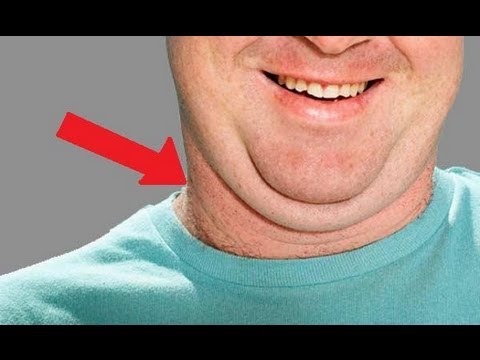 How to Get Rid of Chin and Neck Fat: Lose Double Chin Fast ...
