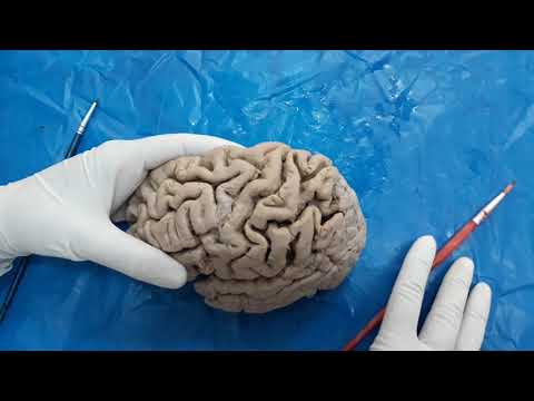 Cerebral hemisphere  (Sulci and Gyri)- Neuroanatomy