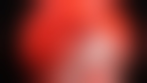 Optic nerve decompression ( Video 3 ) -  Prof. P.J.Wormald