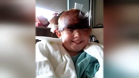 11-Year-Old Girl Sees Herself For First Time After...