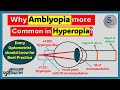 Why amblyopia is more common in hyperopia than myopia