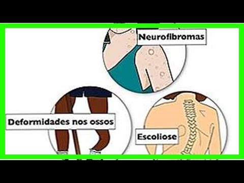 Symptome der Neurofibromatose