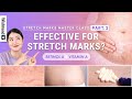 Which one is better, Retinol A or Vitamin A? | Stretch Marks Master Class PART.2