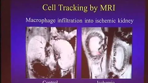 Tracking Single Cells in the Brain with Alan Koret...