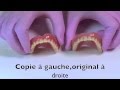 Dupliquer copier un dentier extraits de la replicadent