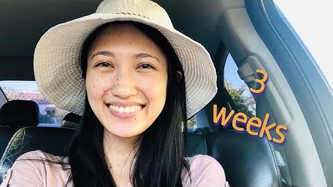 What’s the workload like in OT fieldwork level 2? | Acute care