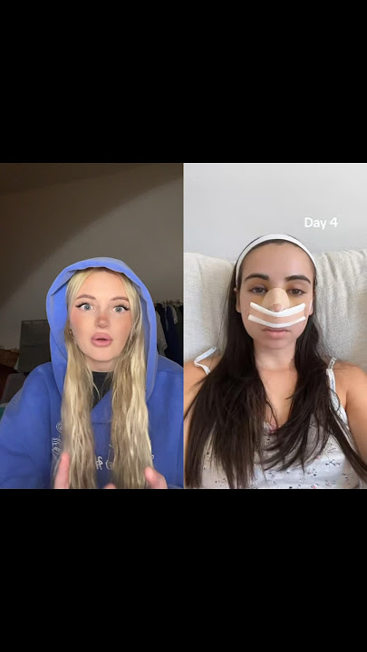 WOW! CHECK OUT HER RESULTS! Creator: ines.roml #viral #fyp #beforeandafter