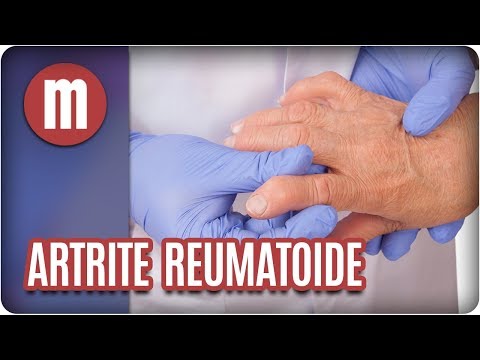 Vídeo: 11 Efeitos Da Artrite Reumatóide No Corpo