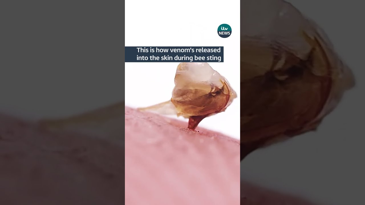 This Is How Venom S Released Into The Skin During Bee Sting Itvnews