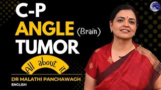 3 Treatment Options For Cerebellopontine Angle Tumors That Actually Work