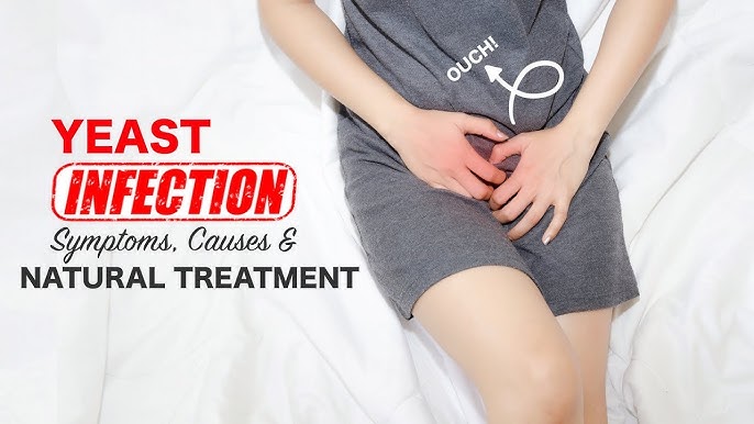 Naturally Treat Vaginal Yeast Infections At 2024