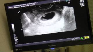 8 Week Ultrasound! - Baby #4