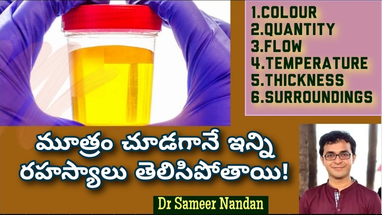 మూత్రం (Urine) లో ఈ మార్పులొస్తే జాగ్రత్త పడండి - Dr Sameer Nandan