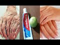 How To Make Hands White And Wrinkle-free With Toothpaste And Lemon | สูตรมือขาวสวย ไร้รอยย่นเหี่ยว