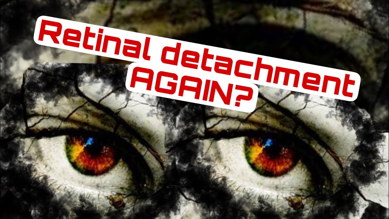 11: Can you get Retinal Detachment AGAIN / RETINAL DETACHMENT/